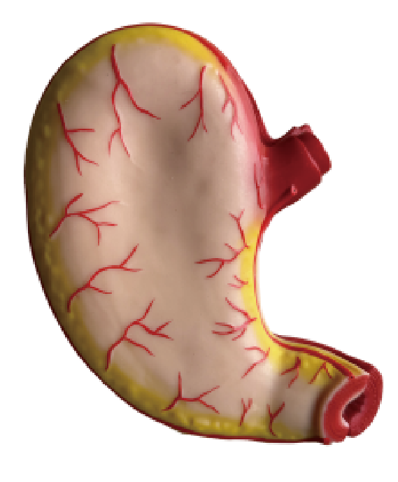 Inael Enlarged Stomach Anatomy Model