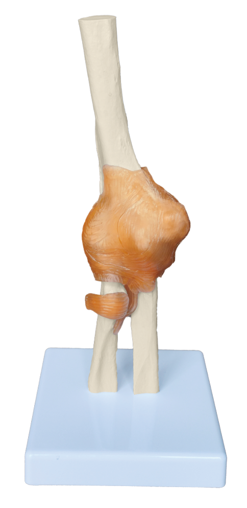 Inael Elbow Joint Model
